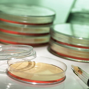 photo Petri dishes
